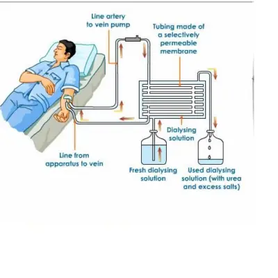 av-fistula-surgery-in-lucknow